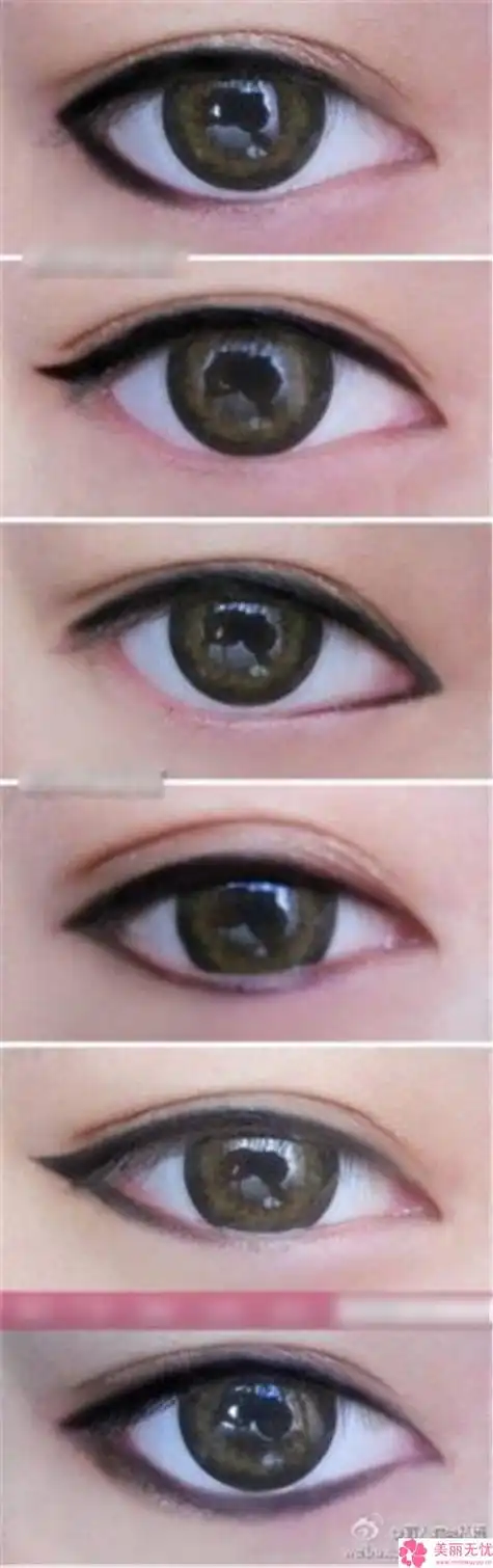 盐城做眼睛斜视矫正手术效果怎么样价格贵不贵